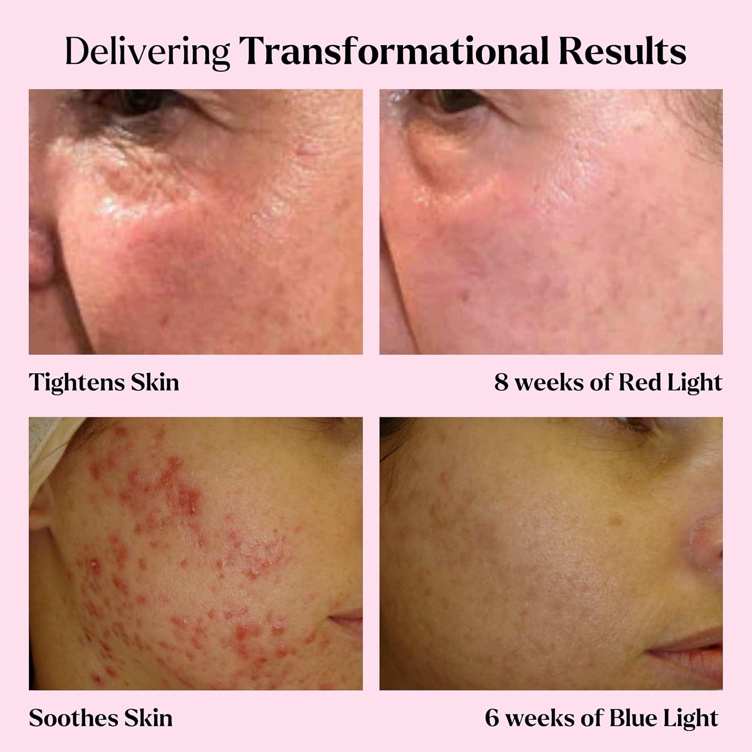 LED Face Mask Light Therapy Premium Spa Kit (4 Pcs) - With Ultrasonic Scrubber, Ultrasonic Brush & Green Tea Serum - 7 Colors (Blue & Red) Light Therapy Mask -Spa Light Therapy Facial For Rejuvenation